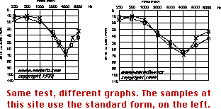 Normal Hearing Test Chart