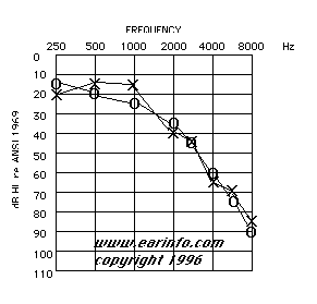 Hearing Loss Range Chart