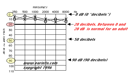 Hearing Chart