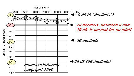 Decibels And Hearing Loss Chart