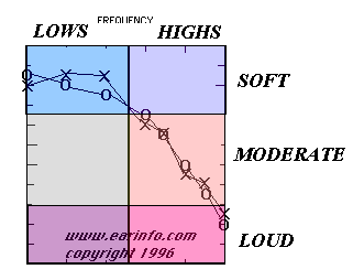 Decibel Ear Damage Chart